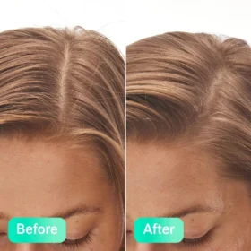 The INKEY List Salicylic Acid Exfoliating Scalp Treatment 150ml