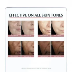 Eucerin Anti-Pigment Face Cream with SPF 30 for Pigmentation & Dark Spots with Thiamidol 50ml
