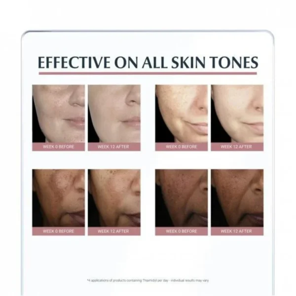 Eucerin Anti-Pigment Face Cream with SPF 30 for Pigmentation & Dark Spots with Thiamidol 50ml